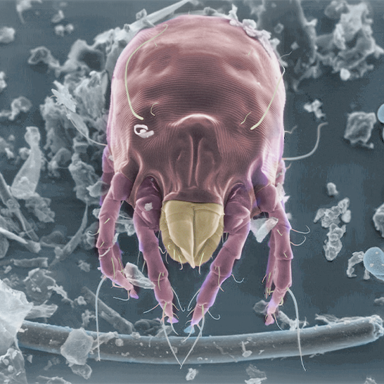 Everything you need to know about dust mites, the leading cause of respiratory allergies